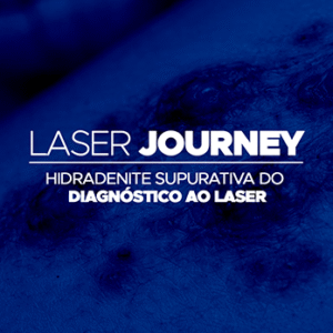 Laser Journey